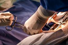 Phẫu thuật lấy con sán dây dài 1,8 mét ra khỏi ruột bệnh nhân